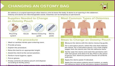 How much fluid should you consume in a day with an ostomy bag?